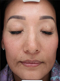 Case # 26 after photo