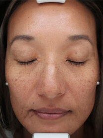 Case # 26 before photo