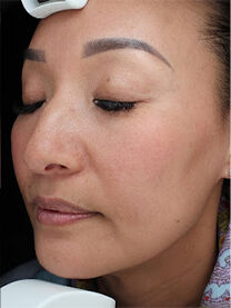 Case # 26 after photo