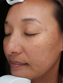 Case # 26 before photo