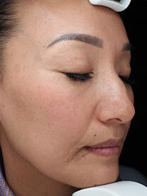 Case # 26 after photo