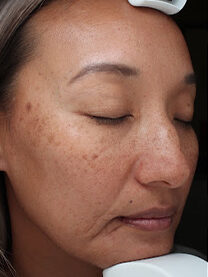 Case # 26 before photo