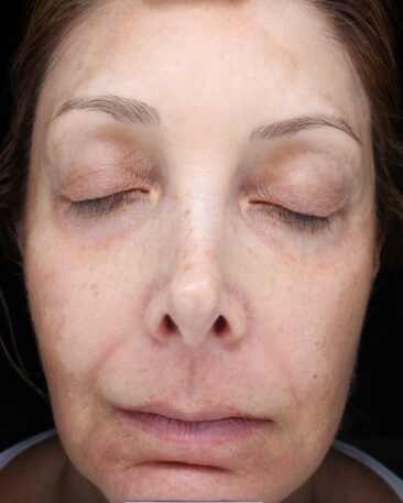 Case # 25 before photo