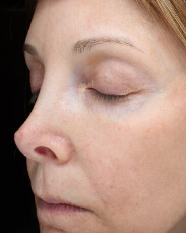 Case # 25 after photo