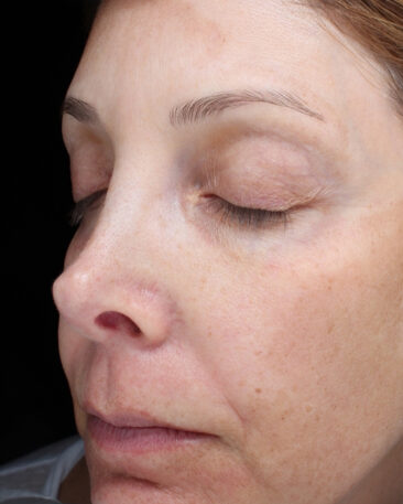 Case # 25 before photo