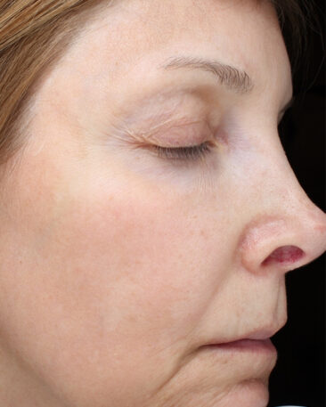 Case # 25 after photo