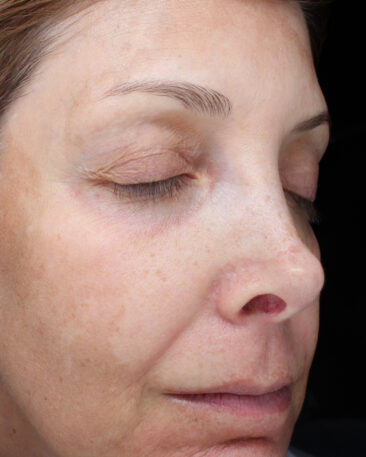 Case # 25 before photo