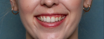 Case # 21 before photo