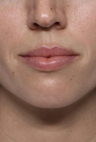 Case # 2 after photo