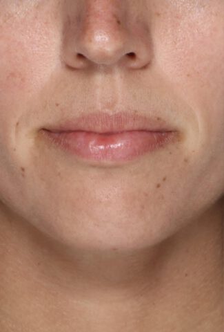 Case # 2 before photo