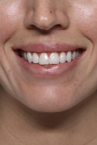 Case # 2 after photo