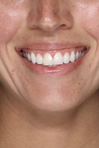 Case # 2 before photo