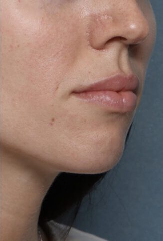 Case # 2 after photo