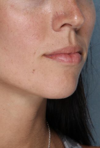 Case # 2 before photo