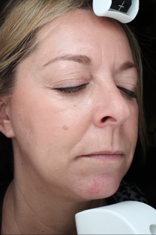 Case # 24 after photo