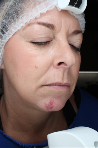 Case # 24 before photo