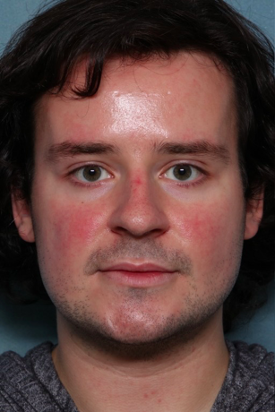 Case # 16 before photo