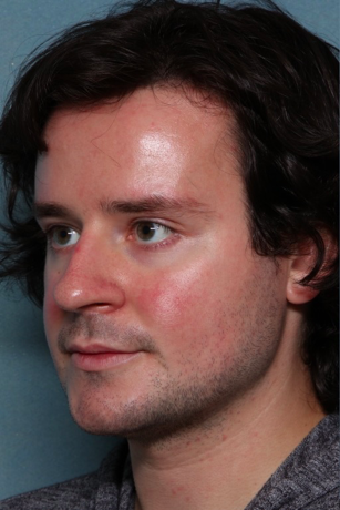 Case # 16 before photo