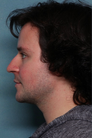 Case # 16 before photo