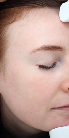 Case # 23 after photo