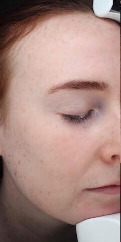 Case # 23 before photo