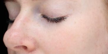 Case # 23 after photo