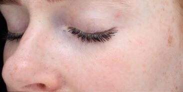 Case # 23 before photo