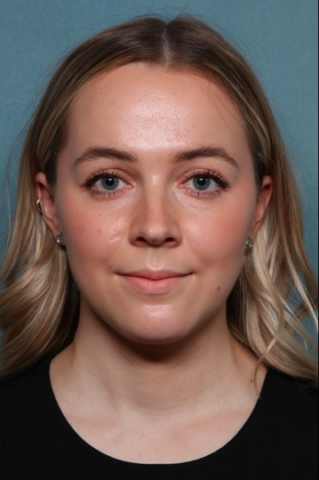 Case # 2 after photo