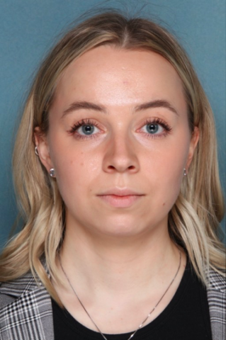 Case # 2 before photo