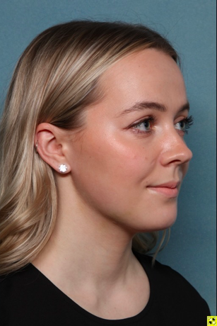 Case # 2 after photo