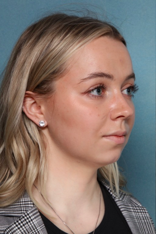 Case # 2 before photo