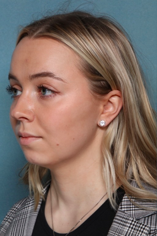 Case # 2 before photo