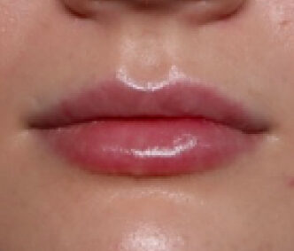 Case # 3 after photo