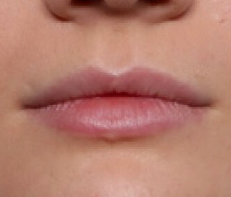 Case # 3 before photo