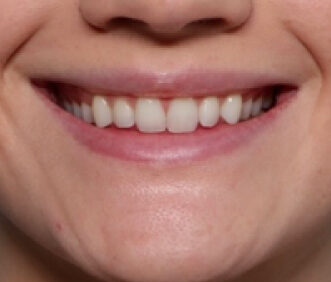 Case # 3 before photo