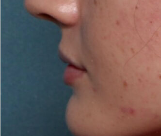 Case # 3 after photo