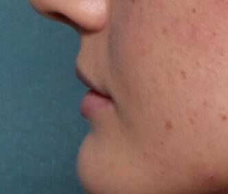 Case # 3 before photo