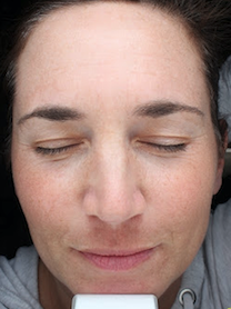 Case # 22 after photo