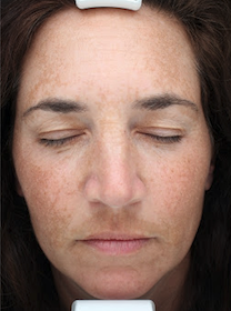 Case # 22 before photo