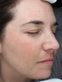 Case # 22 after photo