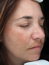 Case # 22 before photo