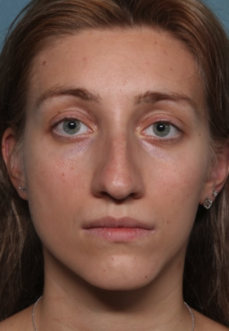 Case # 10 before photo