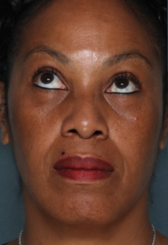 Case # 9 before photo