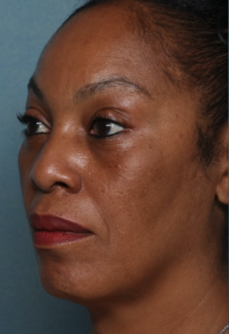 Case # 9 before photo