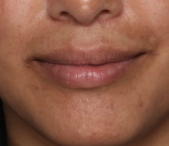 Case # 18 before photo