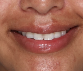 Case # 18 after photo