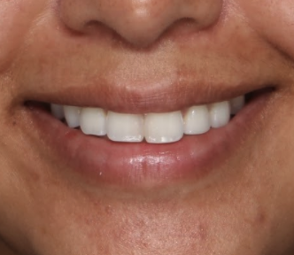 Case # 18 before photo