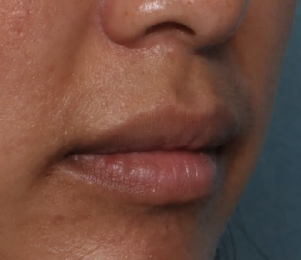 Case # 18 before photo