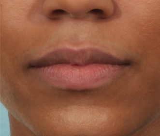 Case # 17 before photo