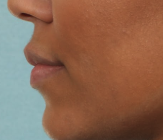 Case # 17 before photo